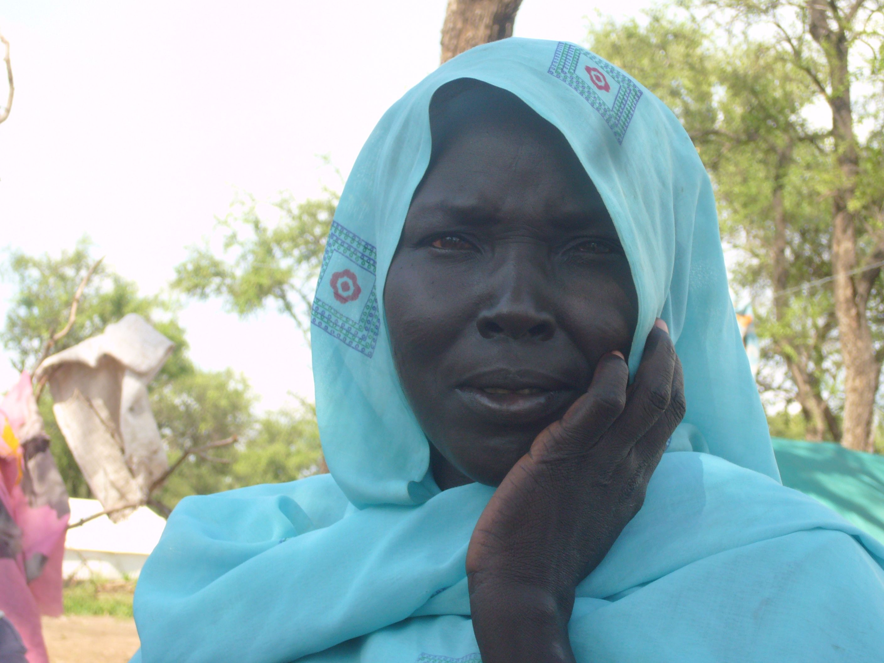 South Sudan mother and malnourished baby